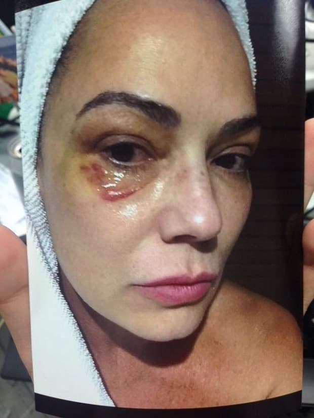 Luiza Brunet "estaria pedindo uma indenização de mais de R$ 60 milhões" ao ex-namorado