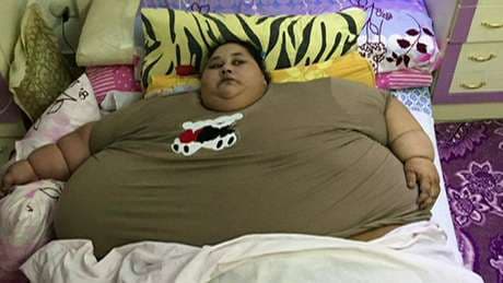 ‘Mulher mais pesada do mundo', egípcia perde 250 kg em dois meses após cirurgia bariátrica