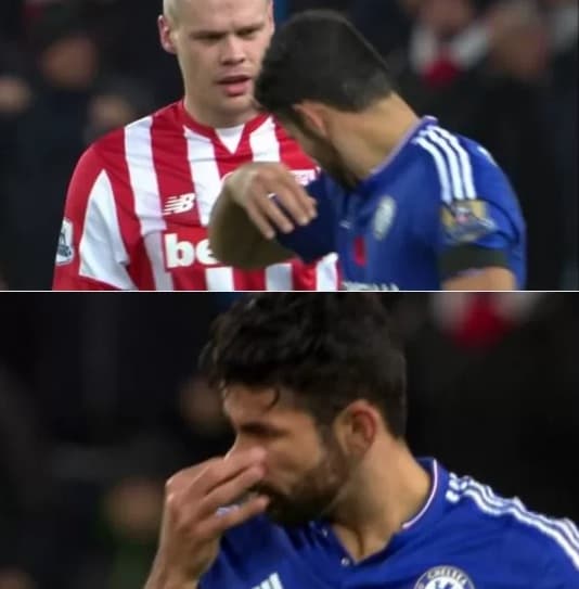 FOTOS: Jogador ganha suprimento de desodorante por um ano após Diego Costa reclamar em campo